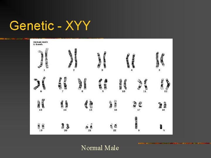 Genetic - XYY Normal Male 