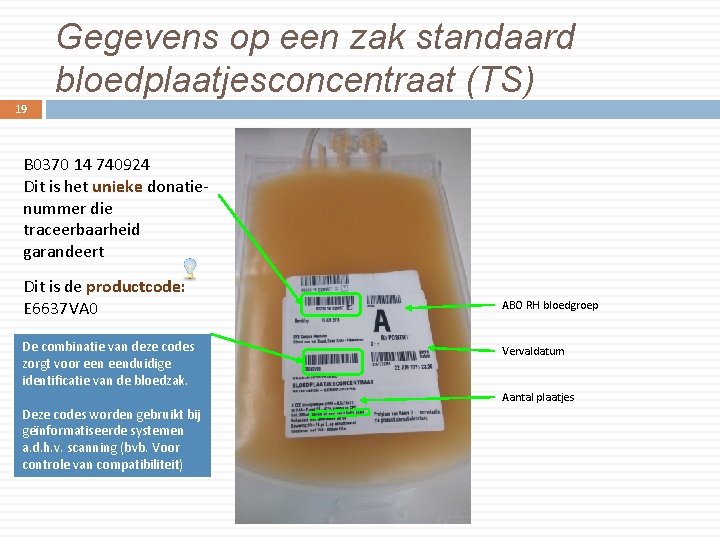 Gegevens op een zak standaard bloedplaatjesconcentraat (TS) 19 B 0370 14 740924 Dit is