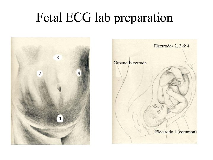 Fetal ECG lab preparation 