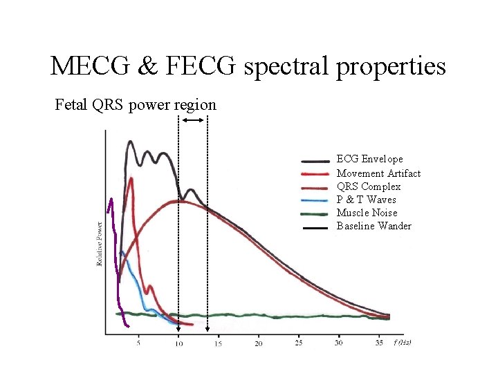 MECG & FECG spectral properties Fetal QRS power region ECG Envelope Movement Artifact QRS