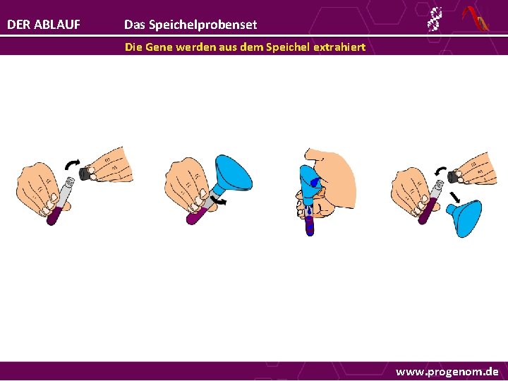 DER ABLAUF Das Speichelprobenset Die Gene werden aus dem Speichel extrahiert www. progenom. de