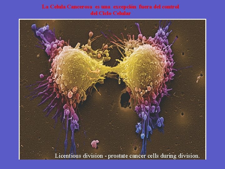 La Celula Cancerosa es una excepción fuera del control del Ciclo Celular Licentious division