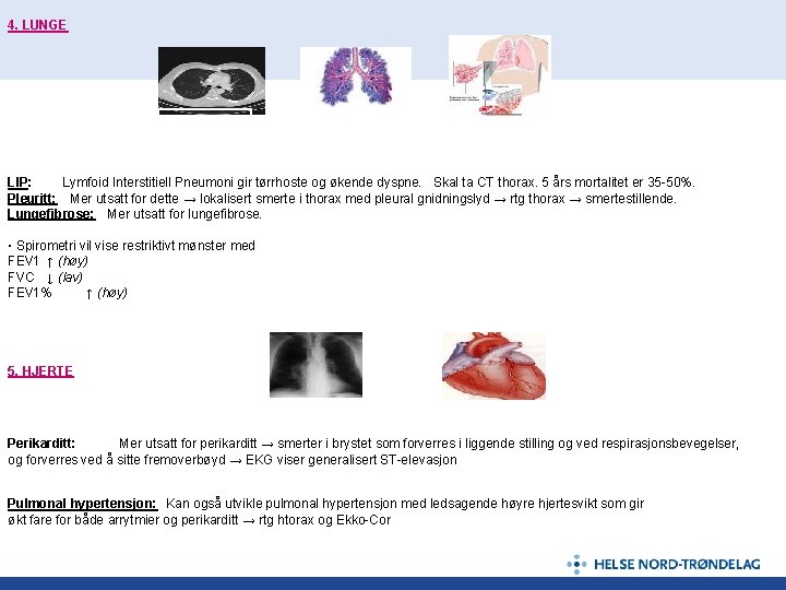 4. LUNGE LIP Pleuritt Fibrose l LIP: Lymfoid Interstitiell Pneumoni gir tørrhoste og økende