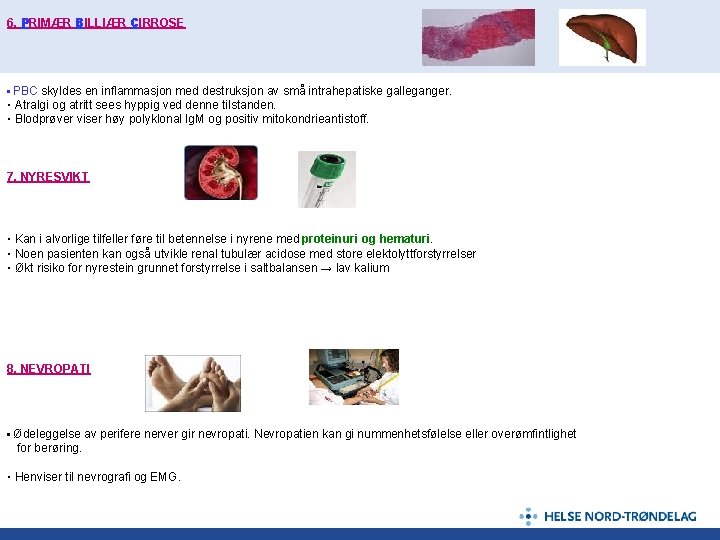 6. PRIMÆR BILLIÆR CIRROSE ▪ PBC skyldes en inflammasjon med destruksjon av små intrahepatiske