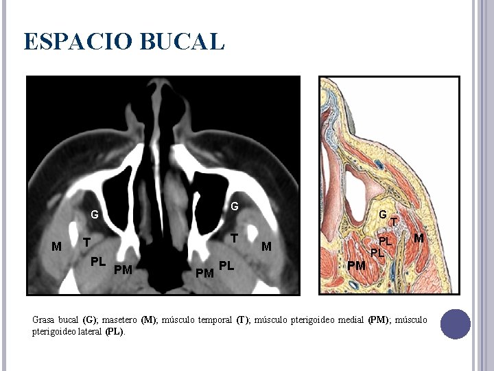 ESPACIO BUCAL G G M T T PL PM PM PL G M PM