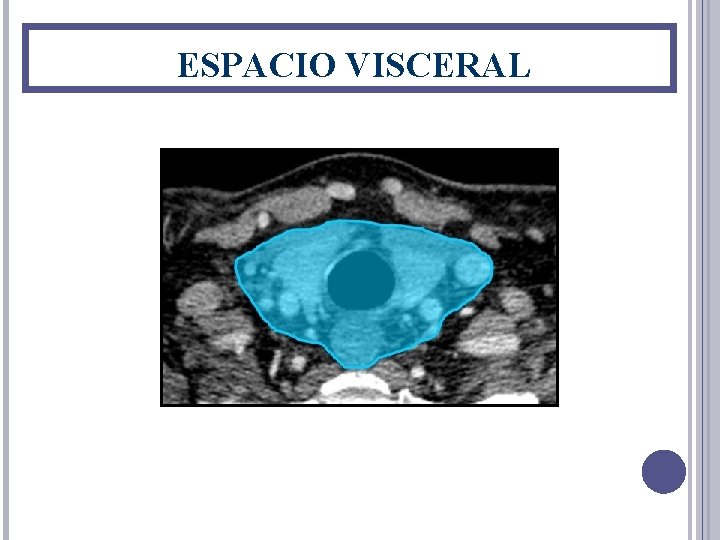 ESPACIO VISCERAL 