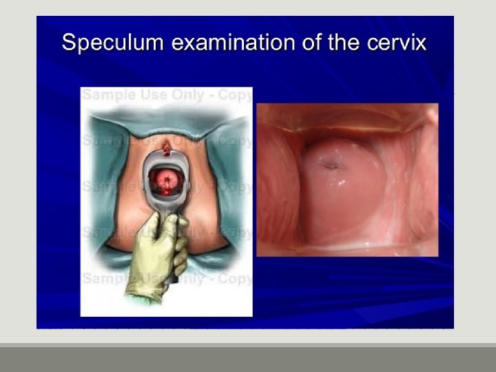 Mechanics of Pelvic Exam Mechanics of Pelvic Exam