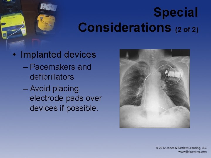 Special Considerations (2 of 2) • Implanted devices – Pacemakers and defibrillators – Avoid