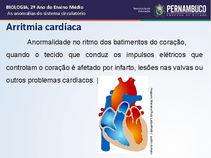BIOLOGIA, 2º Ano do Ensino Médio As anomalias do sistema circulatório Arritmia cardíaca Anormalidade