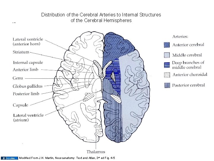 Distribution of the Cerebral Arteries to Internal Structures of the Cerebral Hemispheres Modified From
