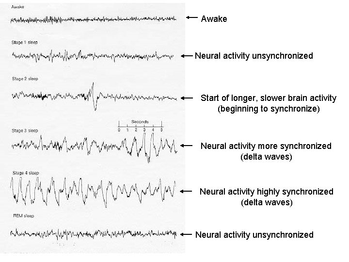 Awake Neural activity unsynchronized Start of longer, slower brain activity (beginning to synchronize) Neural