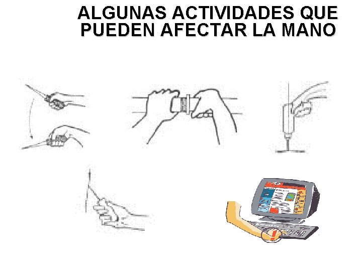 ALGUNAS ACTIVIDADES QUE PUEDEN AFECTAR LA MANO 