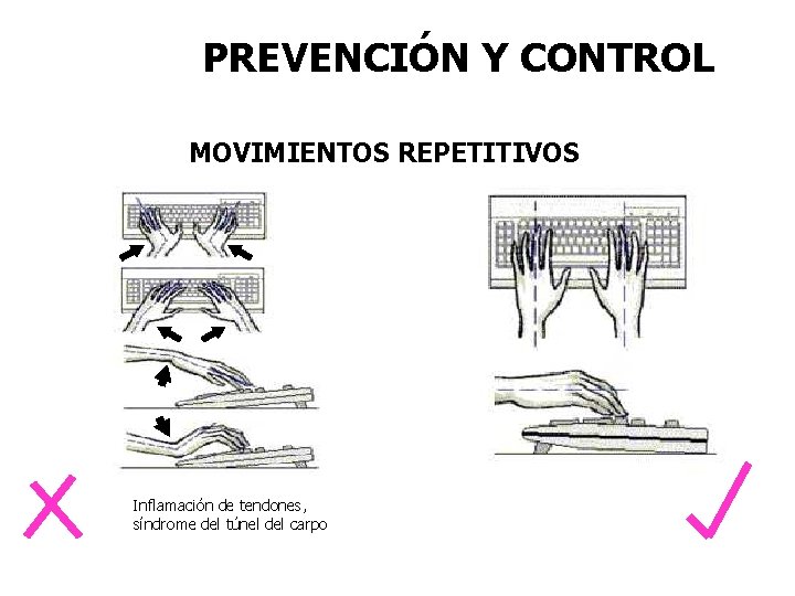 PREVENCIÓN Y CONTROL MOVIMIENTOS REPETITIVOS Inflamación de tendones, síndrome del túnel del carpo 