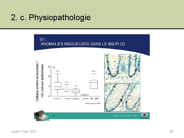 2. c. Physiopathologie Jeudi 17 juin 2010 68 