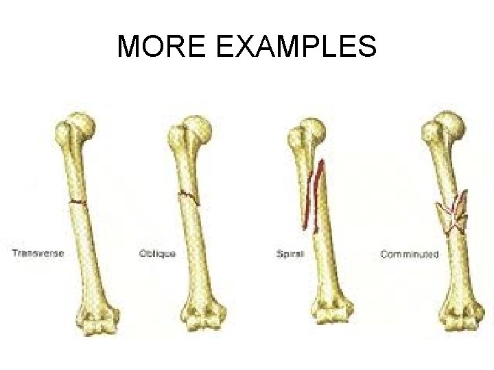 MORE EXAMPLES MORE EXAMPLES