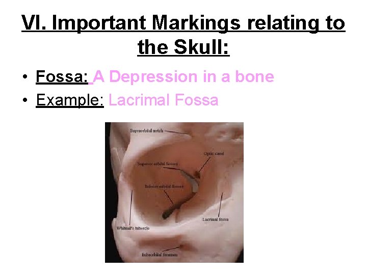 VI. Important Markings relating to the Skull: • Fossa: A Depression in a bone VI. Important Markings relating to the Skull: • Fossa: A Depression in a bone