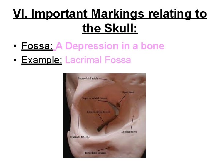 VI. Important Markings relating to the Skull: • Fossa: A Depression in a bone