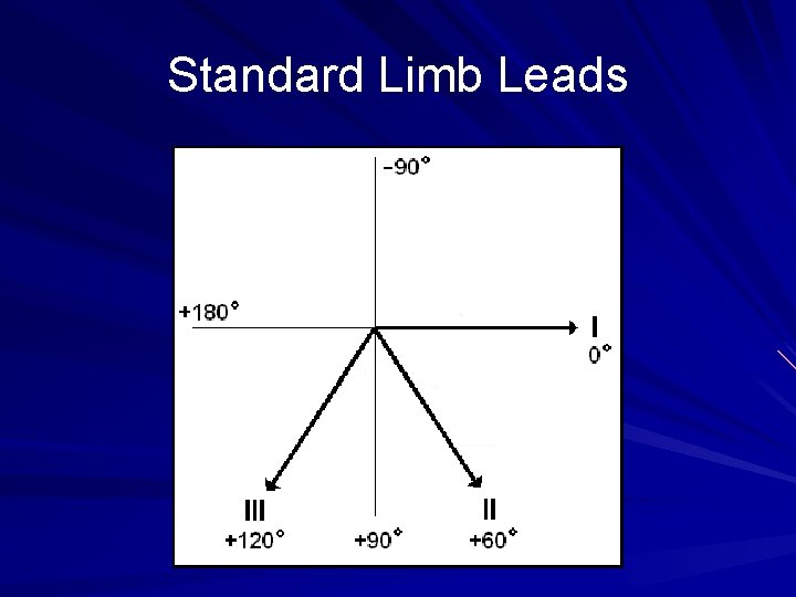 Standard Limb Leads 