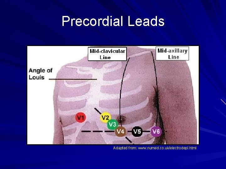 Precordial Leads Adapted from: www. numed. co. uk/electrodepl. html 