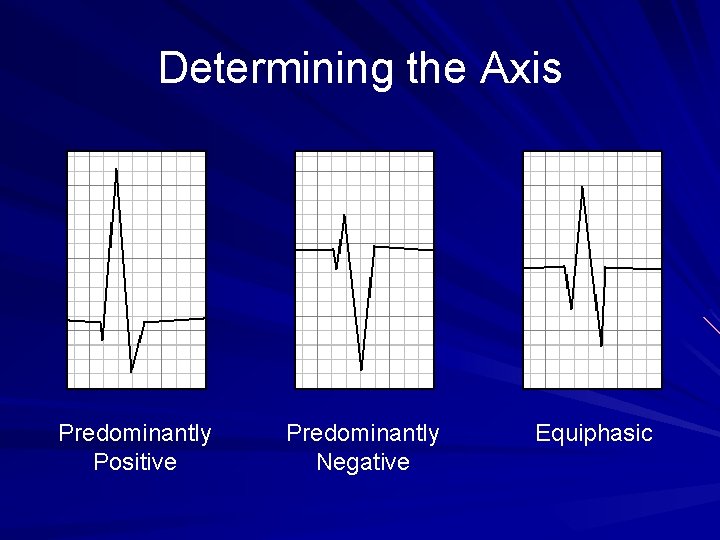 Determining the Axis Predominantly Positive Predominantly Negative Equiphasic 