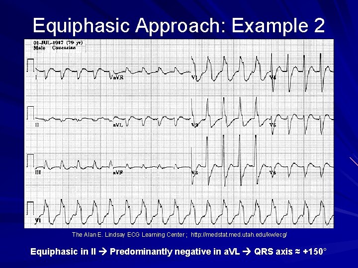 Equiphasic Approach: Example 2 The Alan E. Lindsay ECG Learning Center ; http: //medstat.