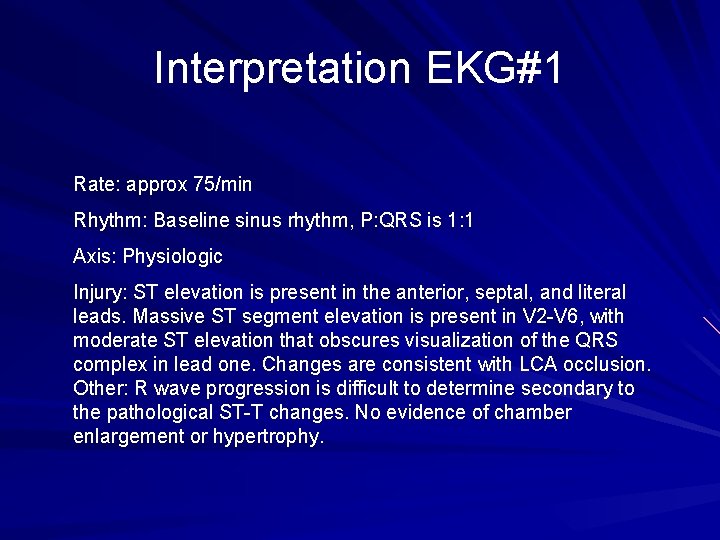 Interpretation EKG#1 Rate: approx 75/min Rhythm: Baseline sinus rhythm, P: QRS is 1: 1