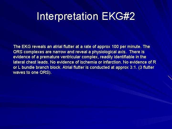 Interpretation EKG#2 The EKG reveals an atrial flutter at a rate of approx 100