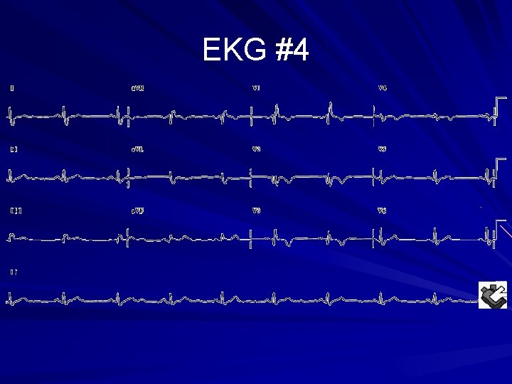 EKG #4 