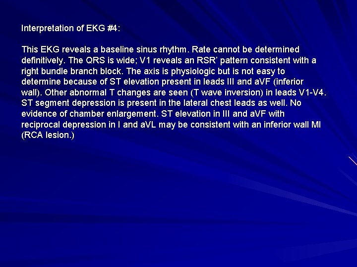 Interpretation of EKG #4: This EKG reveals a baseline sinus rhythm. Rate cannot be
