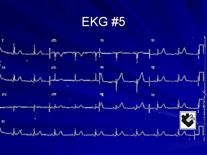 EKG #5 