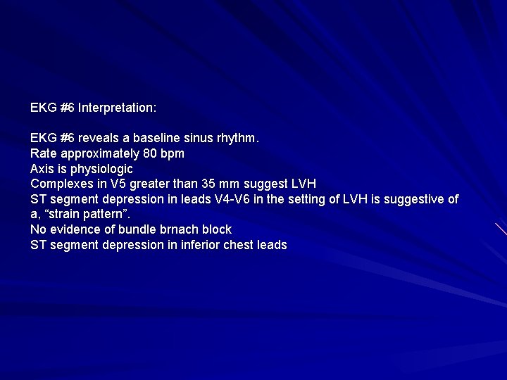EKG #6 Interpretation: EKG #6 reveals a baseline sinus rhythm. Rate approximately 80 bpm