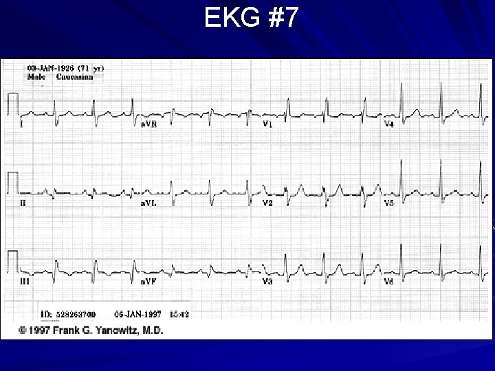 EKG #7 