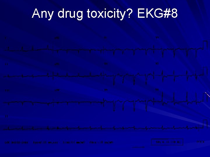 Any drug toxicity? EKG#8 