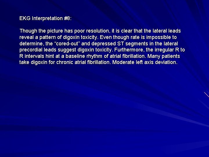 EKG Interpretation #8: Though the picture has poor resolution, it is clear that the