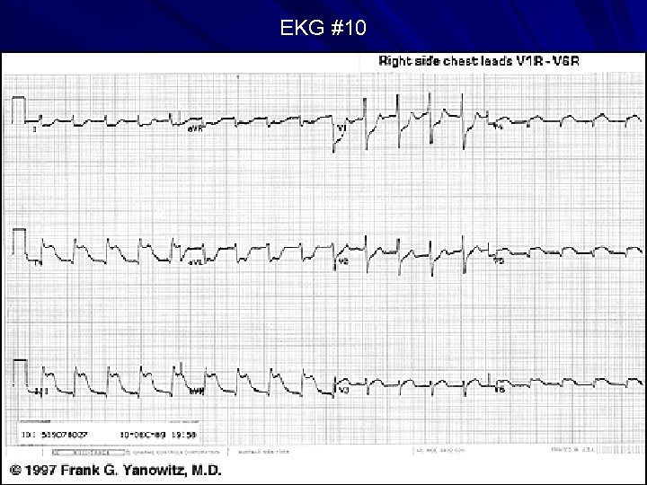 EKG #10 