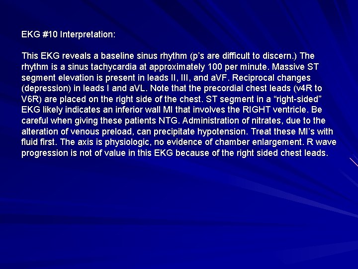 EKG #10 Interpretation: This EKG reveals a baseline sinus rhythm (p’s are difficult to