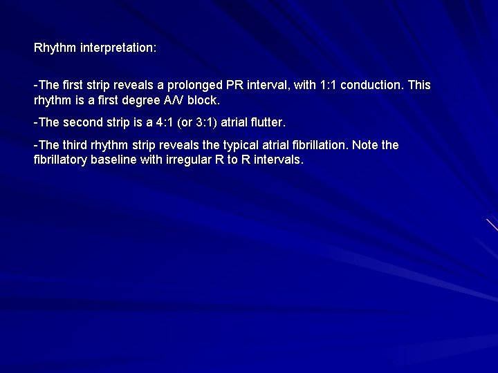 Rhythm interpretation: -The first strip reveals a prolonged PR interval, with 1: 1 conduction.