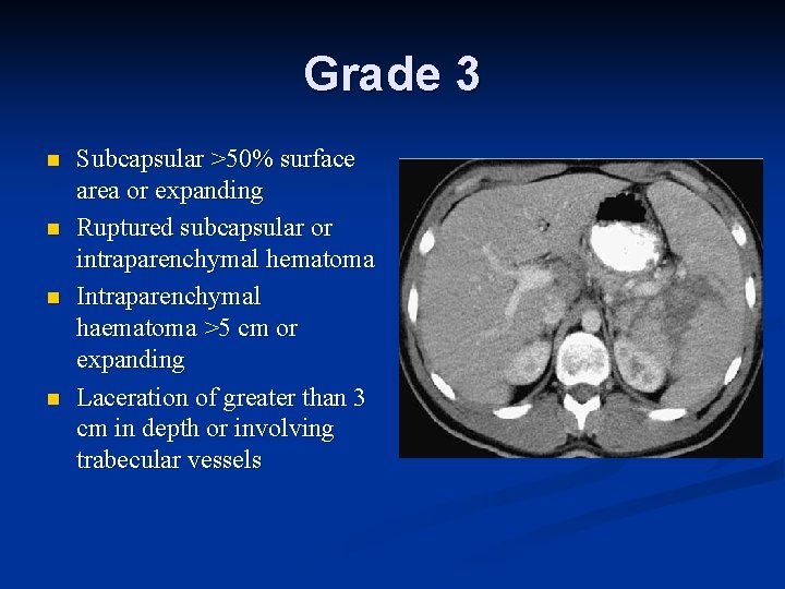 Grade 3 n n Subcapsular >50% surface area or expanding Ruptured subcapsular or intraparenchymal