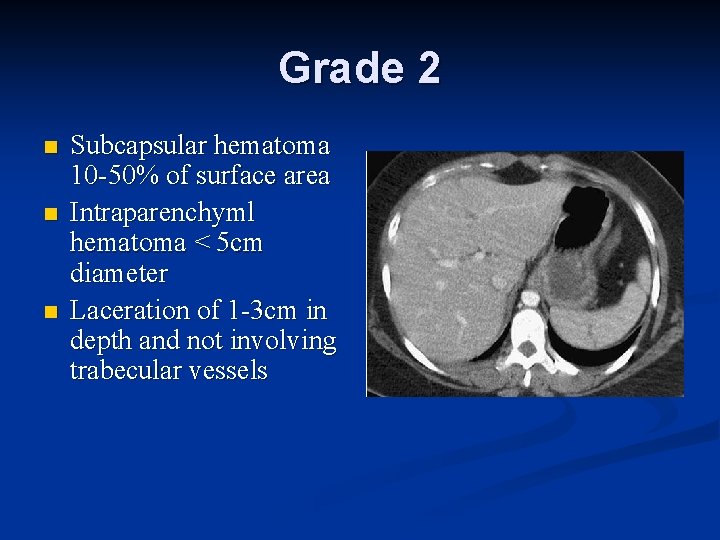 Grade 2 n n n Subcapsular hematoma 10 -50% of surface area Intraparenchyml hematoma