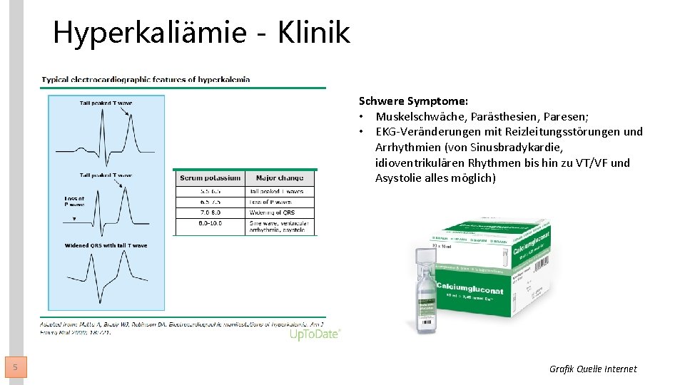 Hyperkaliämie - Klinik Schwere Symptome: • Muskelschwäche, Parästhesien, Paresen; • EKG-Veränderungen mit Reizleitungsstörungen und