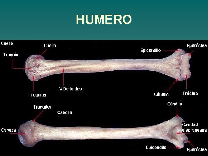 HUMERO 