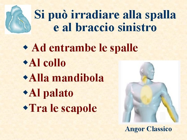 Si può irradiare alla spalla e al braccio sinistro w Ad entrambe le spalle