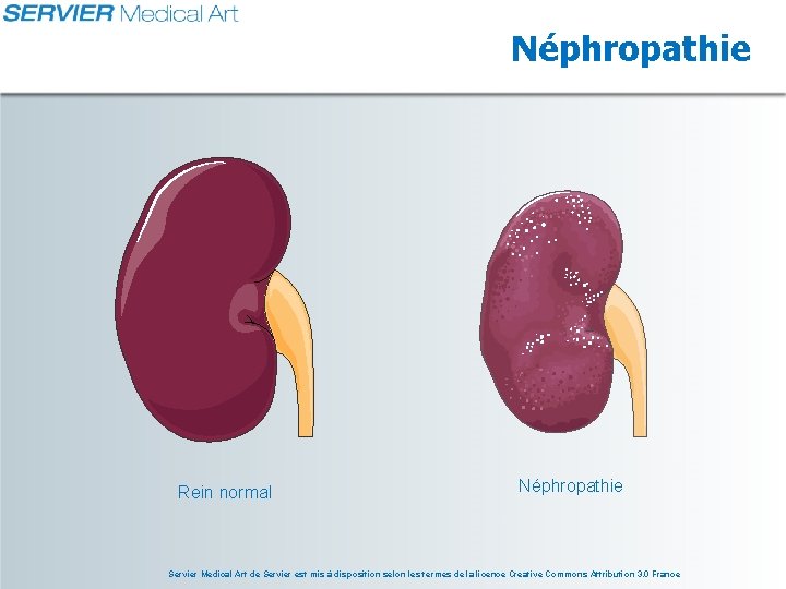 Néphropathie Rein normal Néphropathie Servier Medical Art de Servier est mis à disposition selon