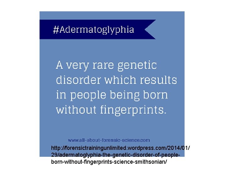 http: //forensictrainingunlimited. wordpress. com/2014/01/ 29/adermatoglyphia-the-genetic-disorder-of-peopleborn-without-fingerprints-science-smithsonian/ 