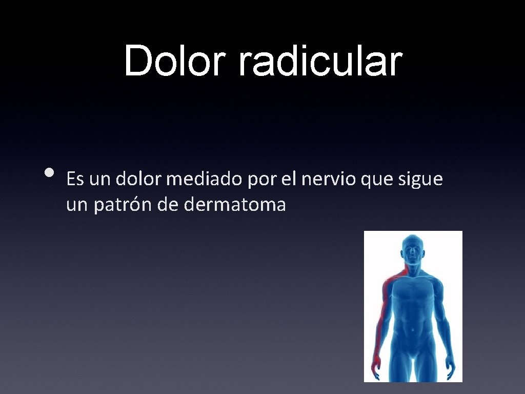 Dolor radicular • Es un dolor mediado por el nervio que sigue un patrón