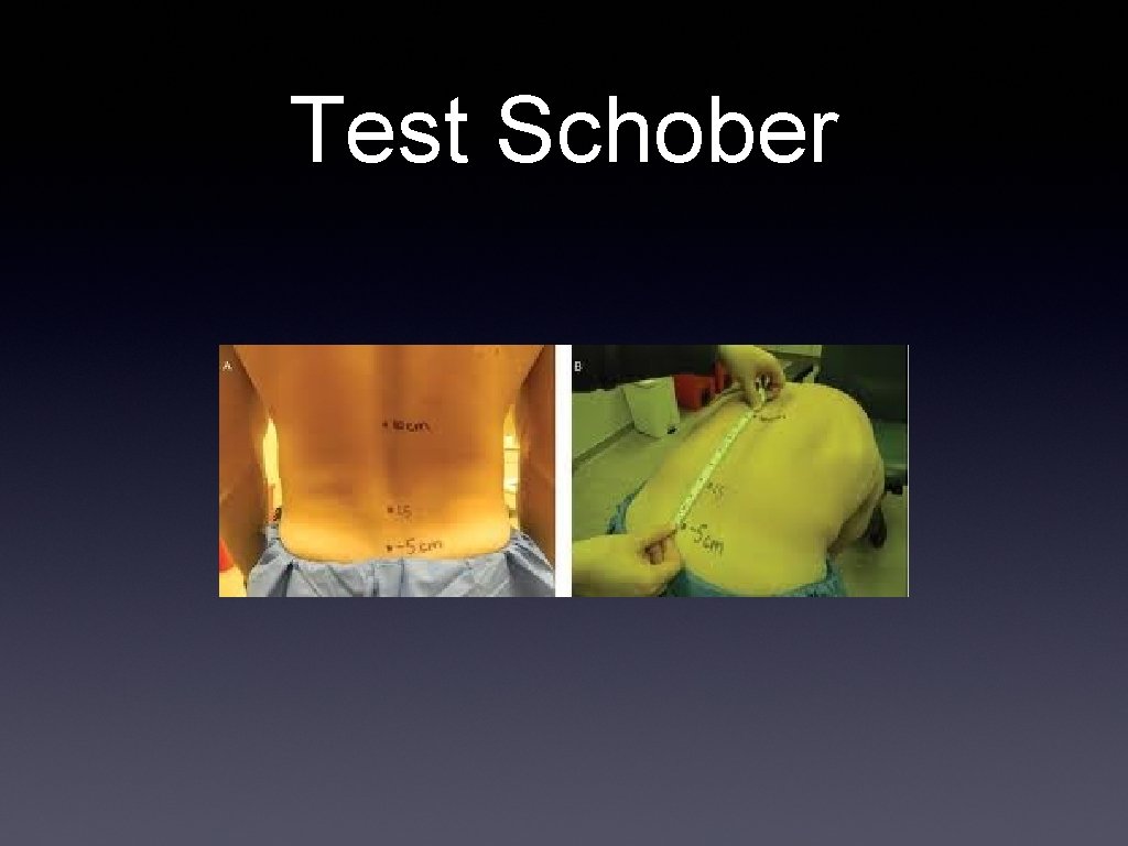 Test Schober 