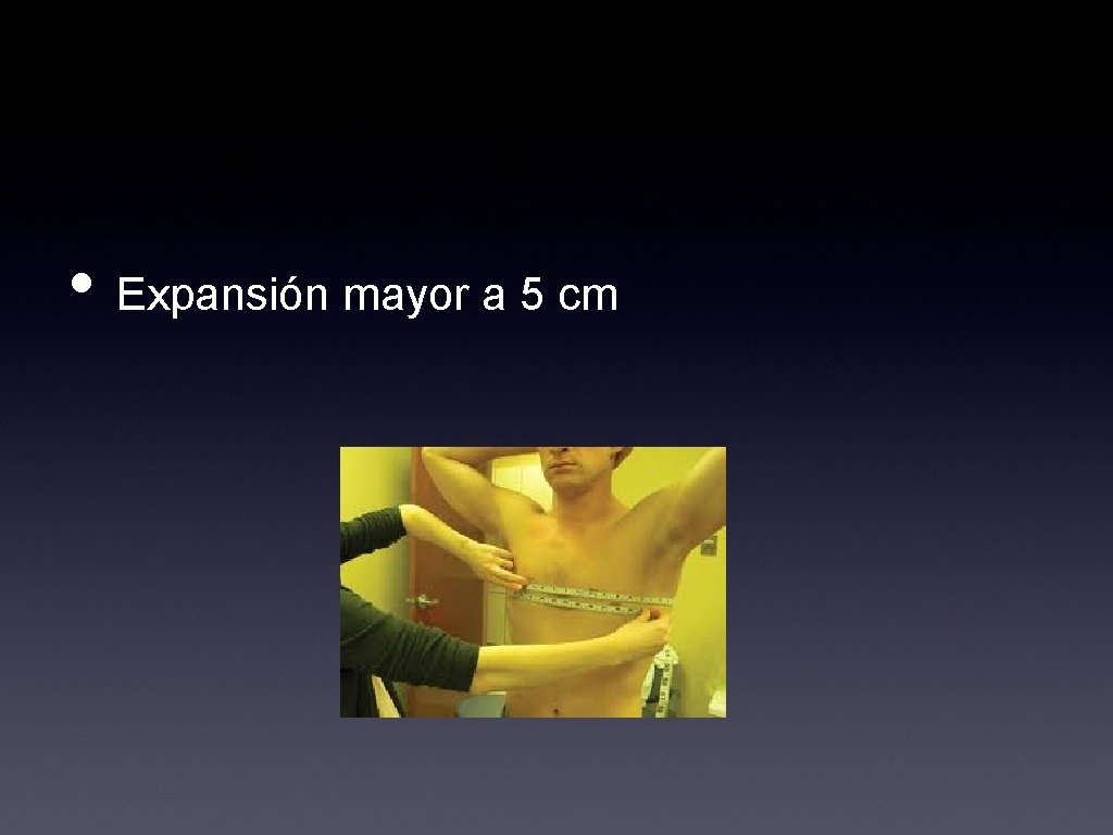  • Expansión mayor a 5 cm 