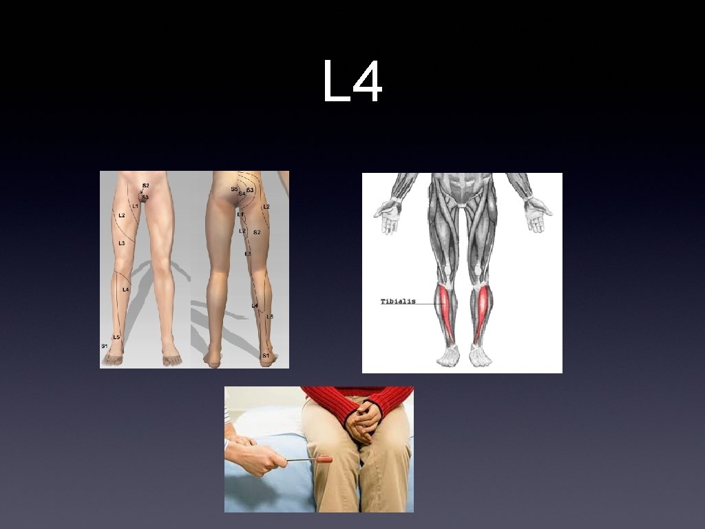 L 4 