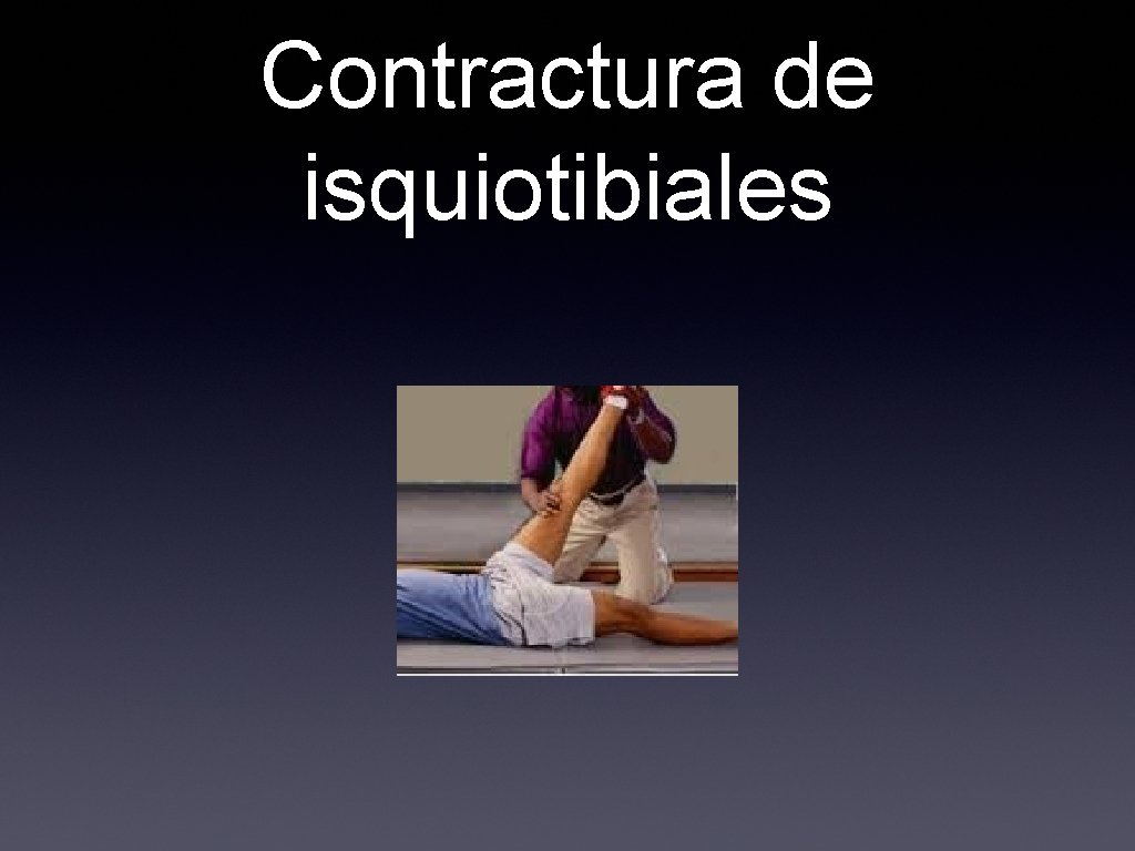 Contractura de isquiotibiales 