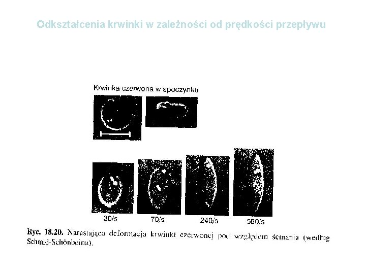 Odkształcenia krwinki w zależności od prędkości przepływu 10 μm 